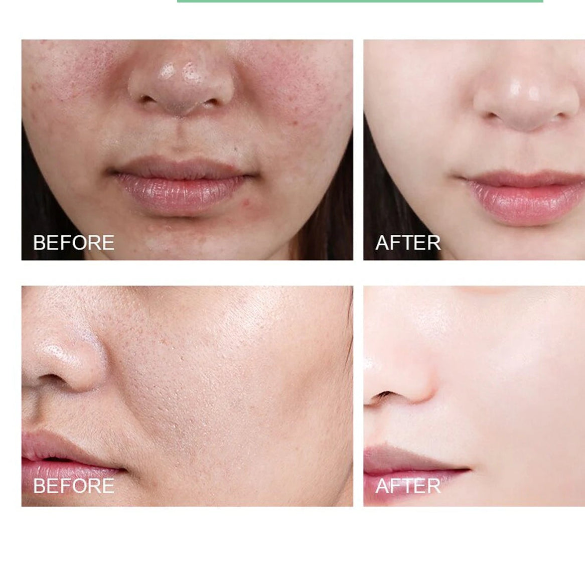 HOYGI exfoliating gel